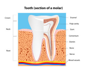 Root Canal